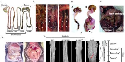 HSV1/2 Genital Infection in Mice Cause Reversible Delayed Gastrointestinal Transit: A Model for Enteric Myopathy